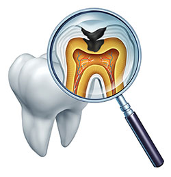 MCDental Care, PLLC | Dental Bridges, Teeth Whitening and Periodontal Treatment