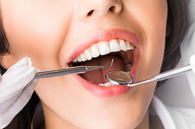 MCDental Care, PLLC | Teeth Whitening, Preventative Program and Ceramic Crowns