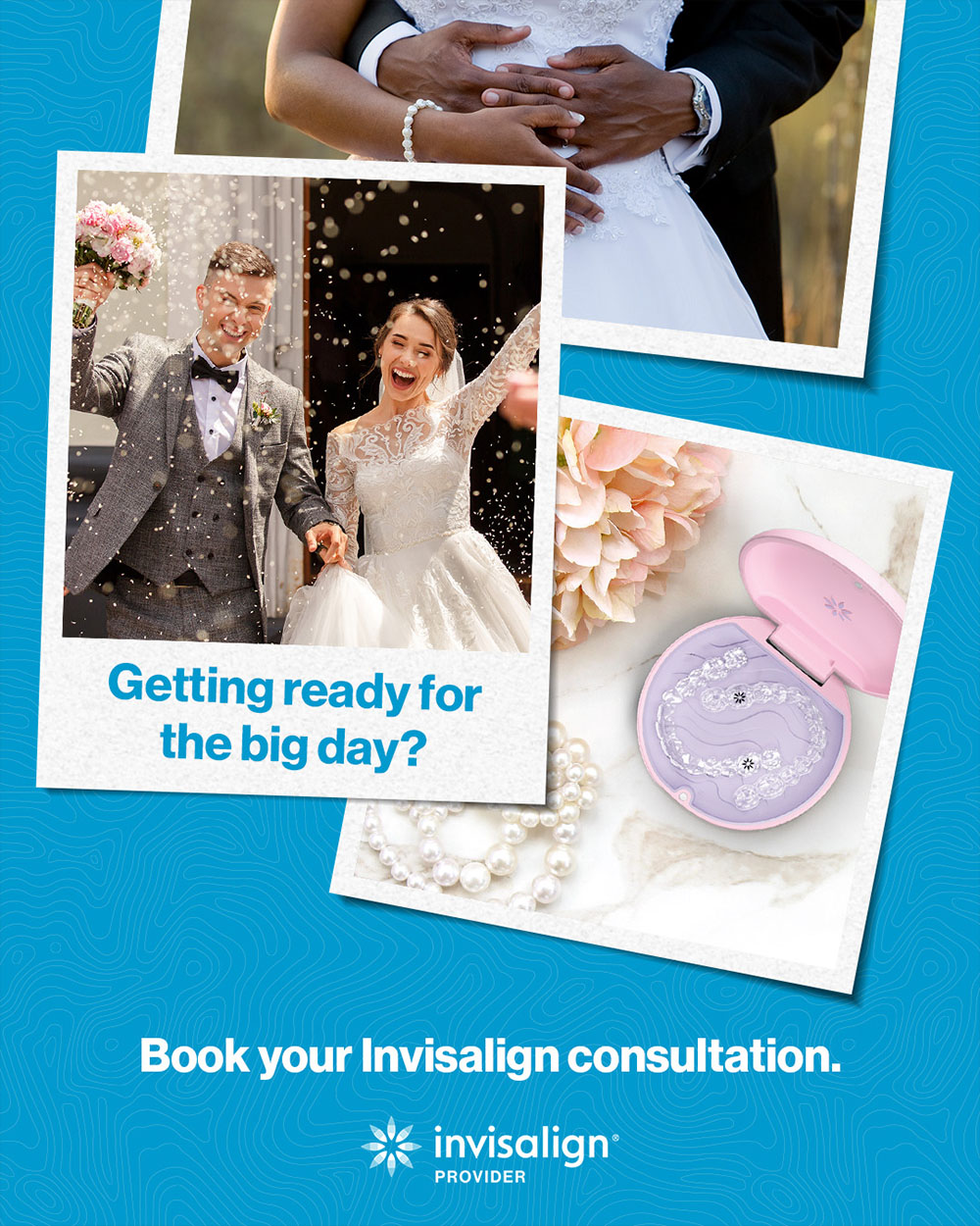 invisalign for brides interior