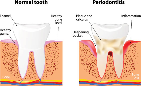 MCDental Care, PLLC | Extractions, Cosmetic Dentistry and Preventative Program