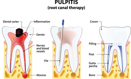 MCDental Care, PLLC | Dentures, Emergency Treatment and Implant Restorations