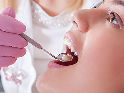 MCDental Care, PLLC | Dental Bridges, Oral Exams and Ceramic Crowns