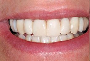 MCDental Care, PLLC | Cosmetic Dentistry, Dentures and Preventative Program
