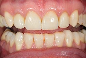 MCDental Care, PLLC | Emergency Treatment, Veneers and Implant Restorations