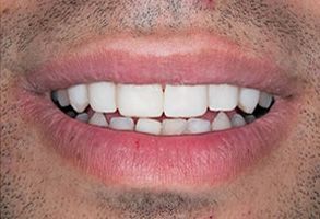 MCDental Care, PLLC | Sleep Apnea, Emergency Treatment and Ceramic Crowns
