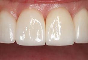 MCDental Care, PLLC | Pediatric Dentistry, Periodontal Treatment and Dental Fillings