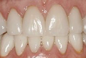 MCDental Care, PLLC | Pediatric Dentistry, Periodontal Treatment and Dental Fillings