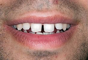 MCDental Care, PLLC | Sedation Dentistry, Teeth Whitening and Pediatric Dentistry