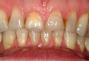 MCDental Care, PLLC | Emergency Treatment, Ceramic Crowns and Extractions