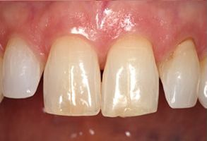 MCDental Care, PLLC | Pediatric Dentistry, Implant Restorations and Snoring Appliances