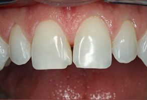 MCDental Care, PLLC | Teeth Whitening, Emergency Treatment and Sleep Apnea